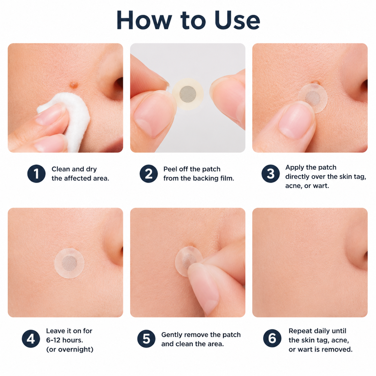 ✨2-in-1 Microneedle & Hydrocolloid Patch🍀| Invisible Patches for Face & Body