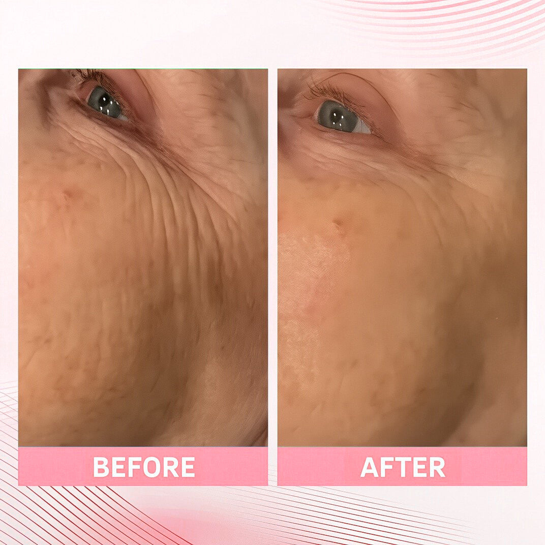 🔥Buy 1 Get 1 Free - PDRN Pink Collagen Volume Multi Balm - Korean Skincare