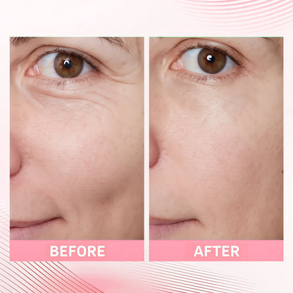 🔥Buy 1 Get 1 Free - PDRN Pink Collagen Volume Multi Balm - Korean Skincare