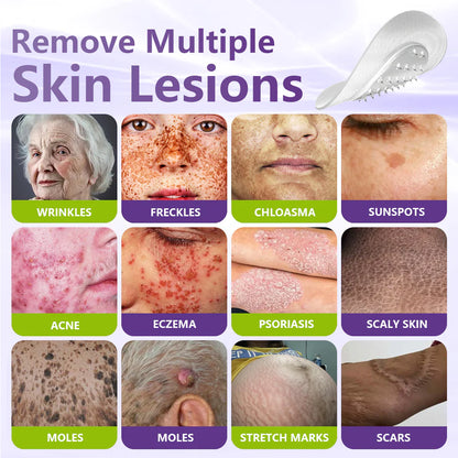 💖BUY 2 GET 1 FREE -✨LOVILDS™ SOLUBLE MICRONEEDLE BOTANICAL SKIN TAG REMOVAL PATCH