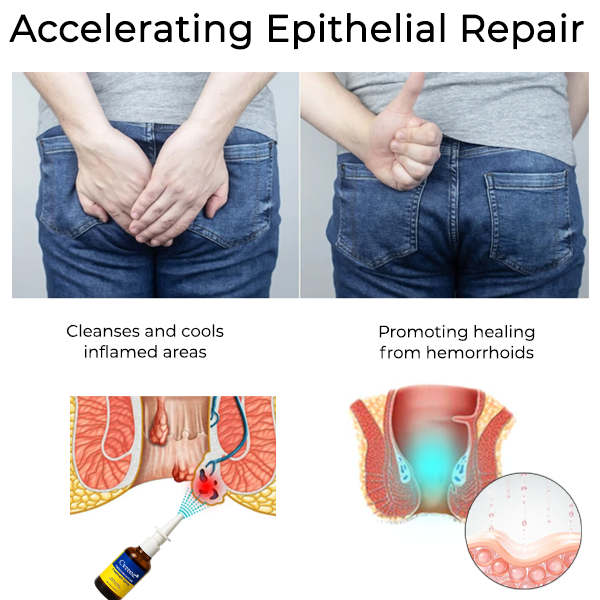HZA Herbal Hemorrhoid Treatment Anal Spray Pro