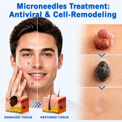 ✨2-in-1 Microneedle & Hydrocolloid Patch🍀| Invisible Patches for Face & Body