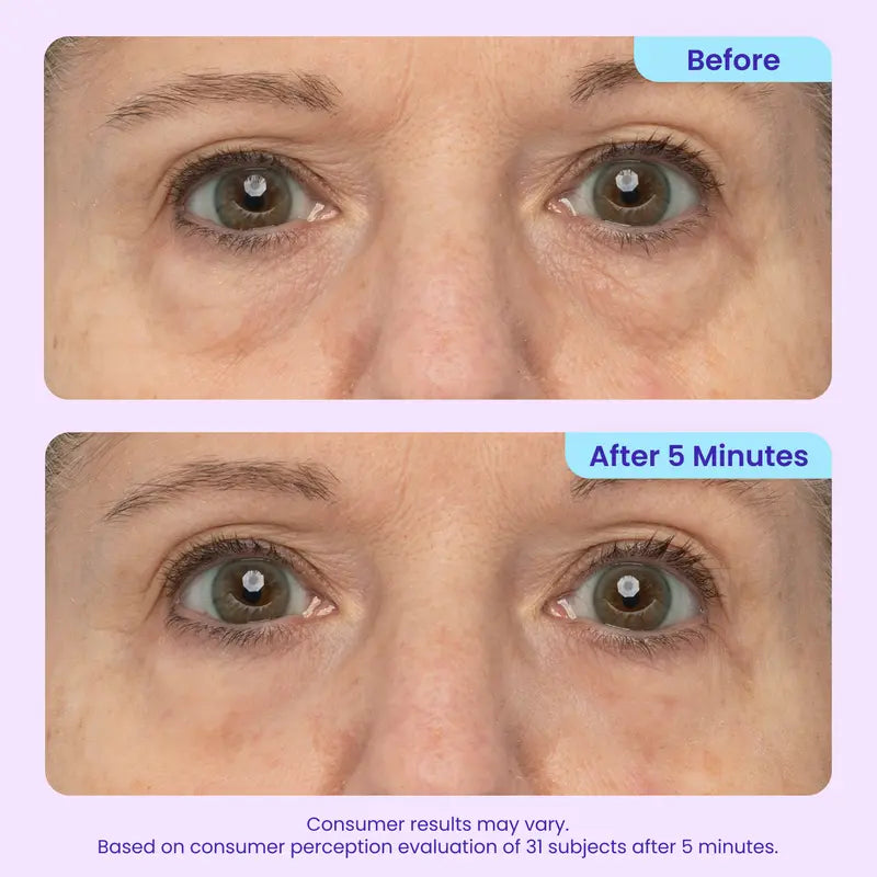 ⏰Limited Time Offer: Buy 1 Get 1 FREE - COUGEX Instant Lift Eye Gel - Care for Men & Women with Under Eye Brightener