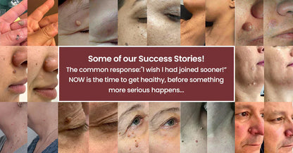 ✨2-in-1 Microneedle & Hydrocolloid Patch🍀| Invisible Patches for Face & Body