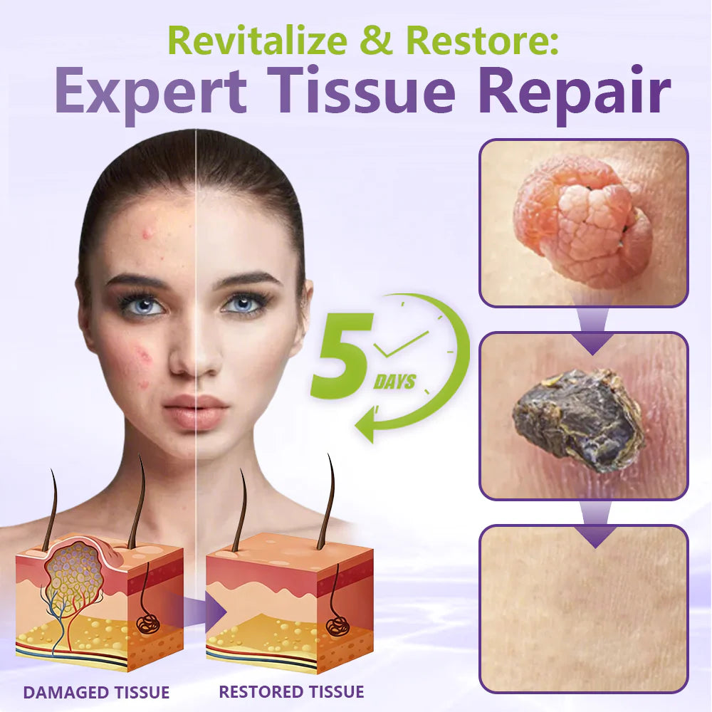 💖BUY 2 GET 1 FREE -✨LOVILDS™ SOLUBLE MICRONEEDLE BOTANICAL SKIN TAG REMOVAL PATCH