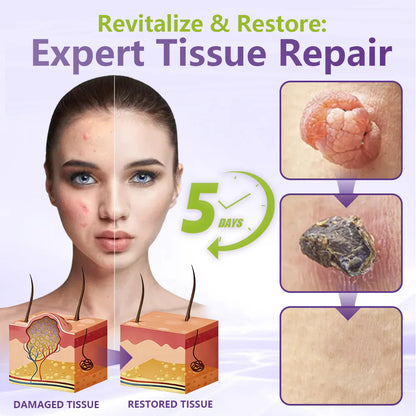 💖BUY 2 GET 1 FREE -✨LOVILDS™ SOLUBLE MICRONEEDLE BOTANICAL SKIN TAG REMOVAL PATCH