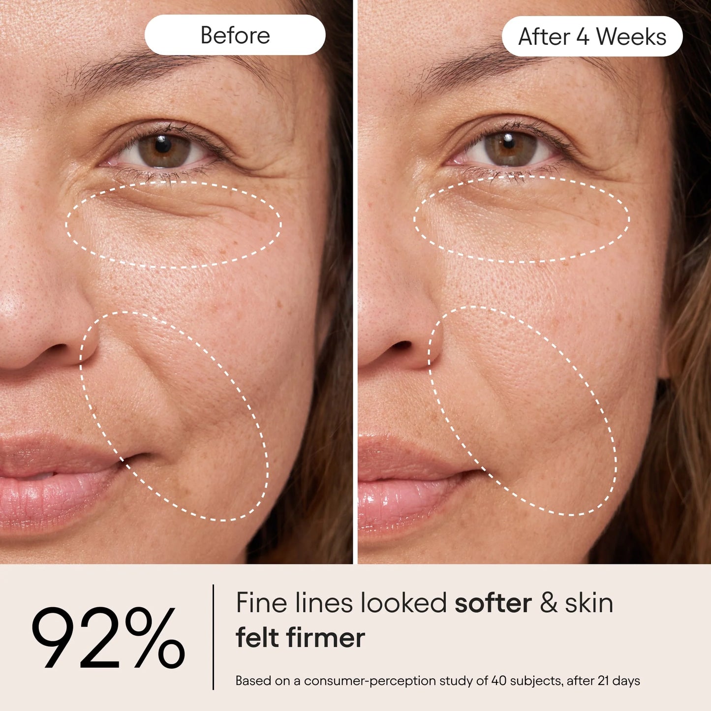 ✨Buy 1 Get 1 Free - 💧QIAWI™ Ultra Peptide Barrier Repair Cream - Repair Damaged Skin Barrier,Reduce Redness & Dryness