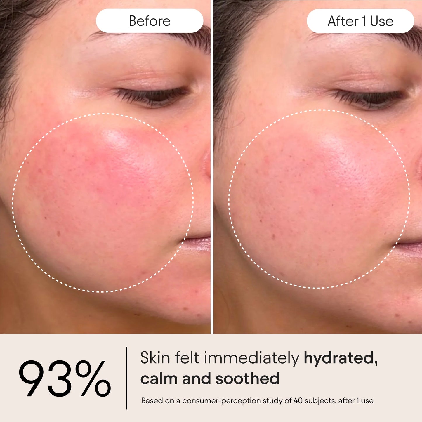 ✨Buy 1 Get 1 Free - 💧QIAWI™ Ultra Peptide Barrier Repair Cream - Repair Damaged Skin Barrier,Reduce Redness & Dryness