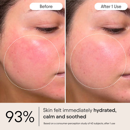 ✨Buy 1 Get 1 Free - 💧QIAWI™ Ultra Peptide Barrier Repair Cream - Repair Damaged Skin Barrier,Reduce Redness & Dryness