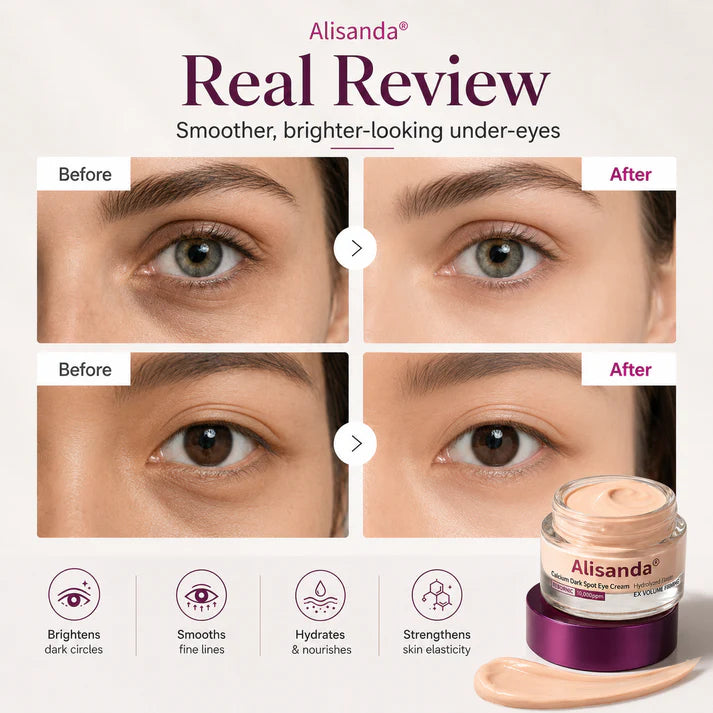 Calcium Dark Spot Eye Cream | Dark Circle, Anti-aging, Sagging, Elasticity | Korean Cosmetics