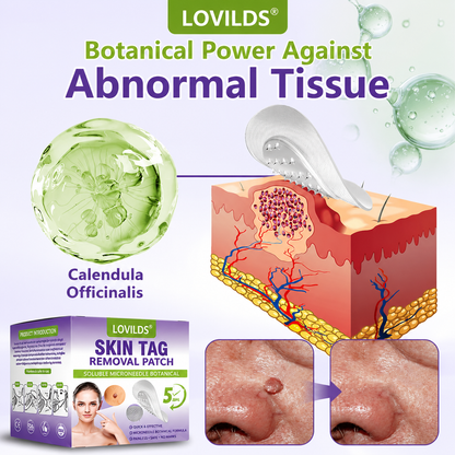 💖BUY 2 GET 1 FREE -✨LOVILDS™ SOLUBLE MICRONEEDLE BOTANICAL SKIN TAG REMOVAL PATCH