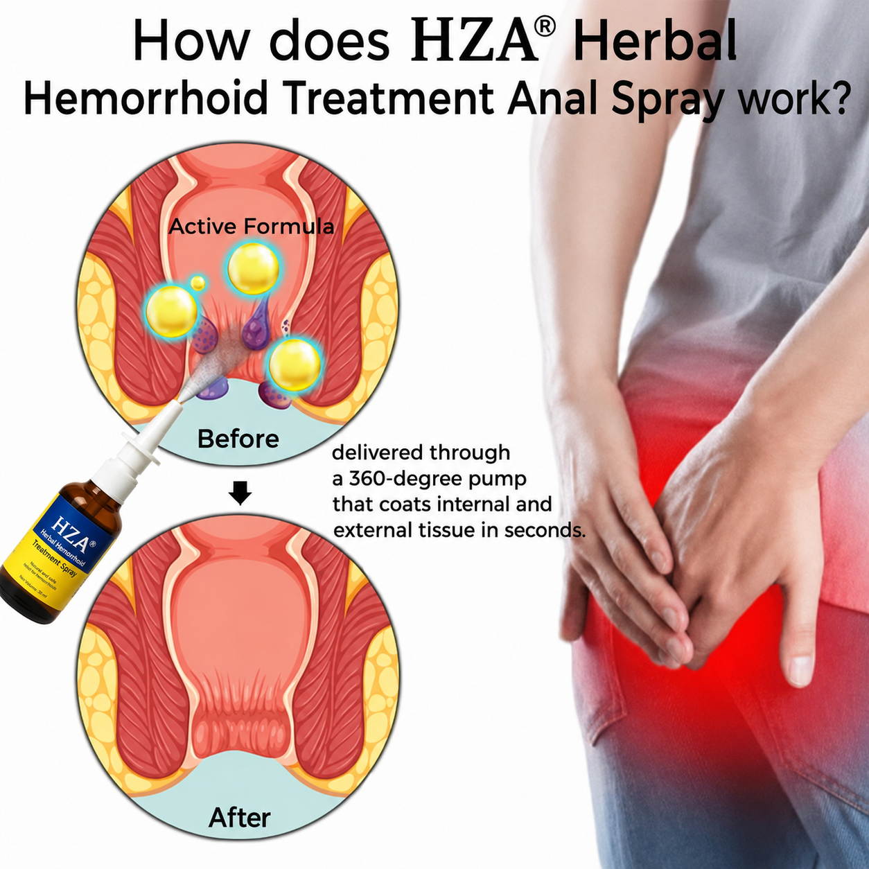 HZA Herbal Hemorrhoid Treatment Anal Spray Pro