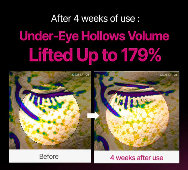Calcium Dark Spot Eye Cream | Dark Circle, Anti-aging, Sagging, Elasticity | Korean Cosmetics