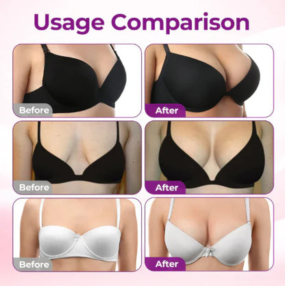 🔥Limited-time 60% sale--Skavix Targeted Breast Enhancement Advanced Nano-Microneedle Patches