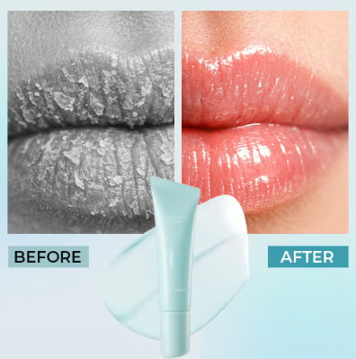 Visible dry flakes before lip mask use