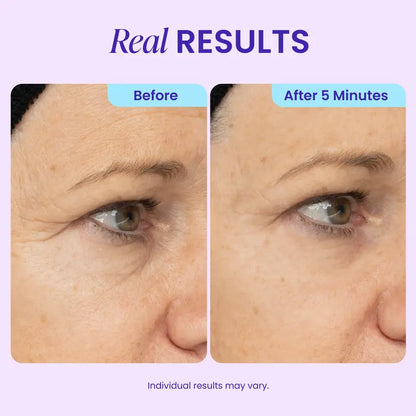 ⏰Limited Time Offer: Buy 1 Get 1 FREE - COUGEX Instant Lift Eye Gel - Care for Men & Women with Under Eye Brightener